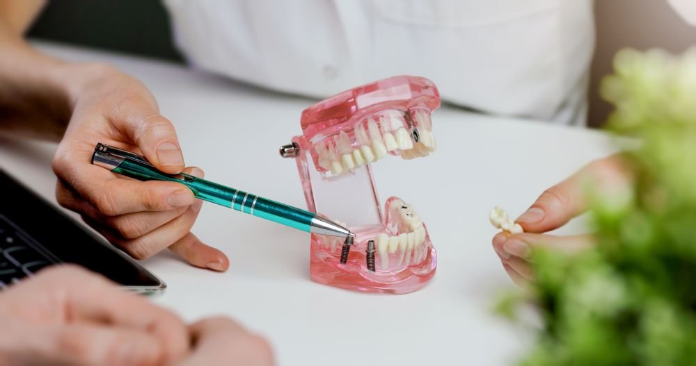 Dental implant consultation and treatment planning in Addis Ababa Ethiopia