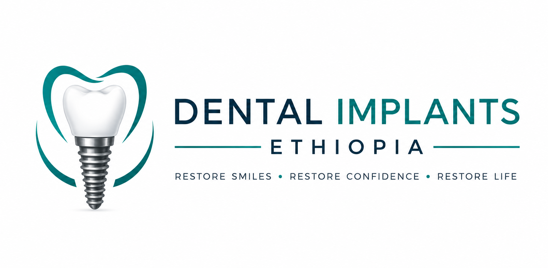 Dental Implants Ethiopia – Implant Dentistry in Addis Ababa