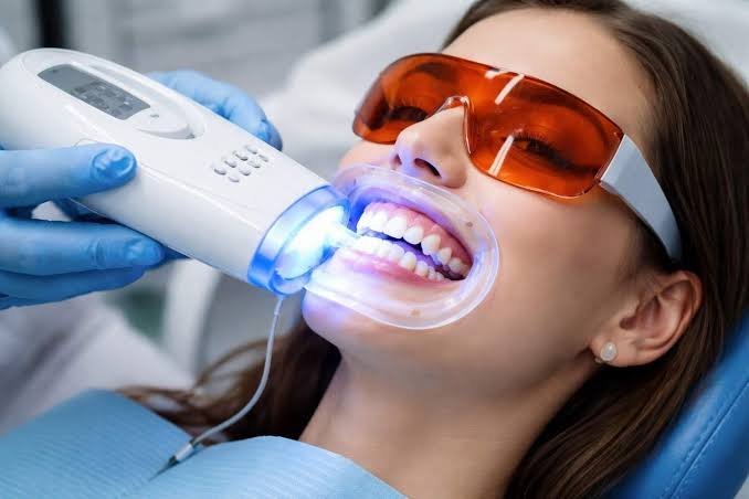 Professional teeth whitening in Addis Ababa Ethiopia