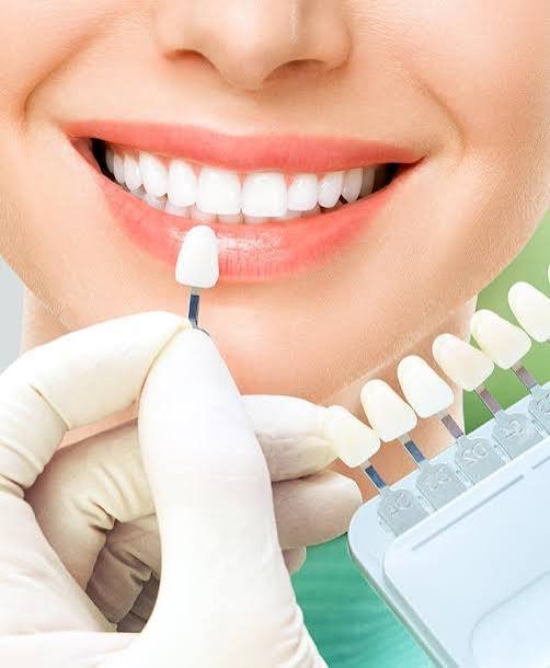 Zirconia crowns in Addis Ababa Ethiopia
